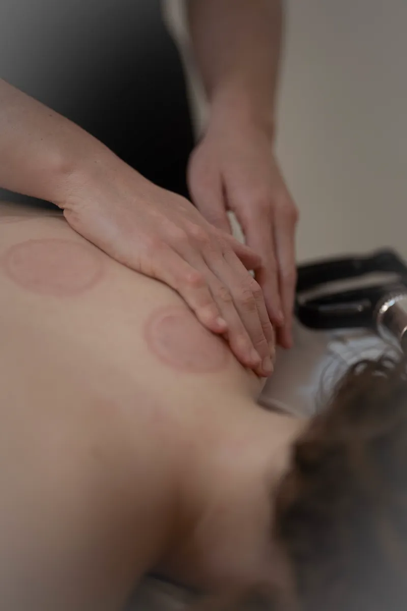 עיסוי רפואי עם / בלי כוסות רוח